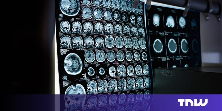 AI nearly twice as good as biopsy at assessing rare cancer